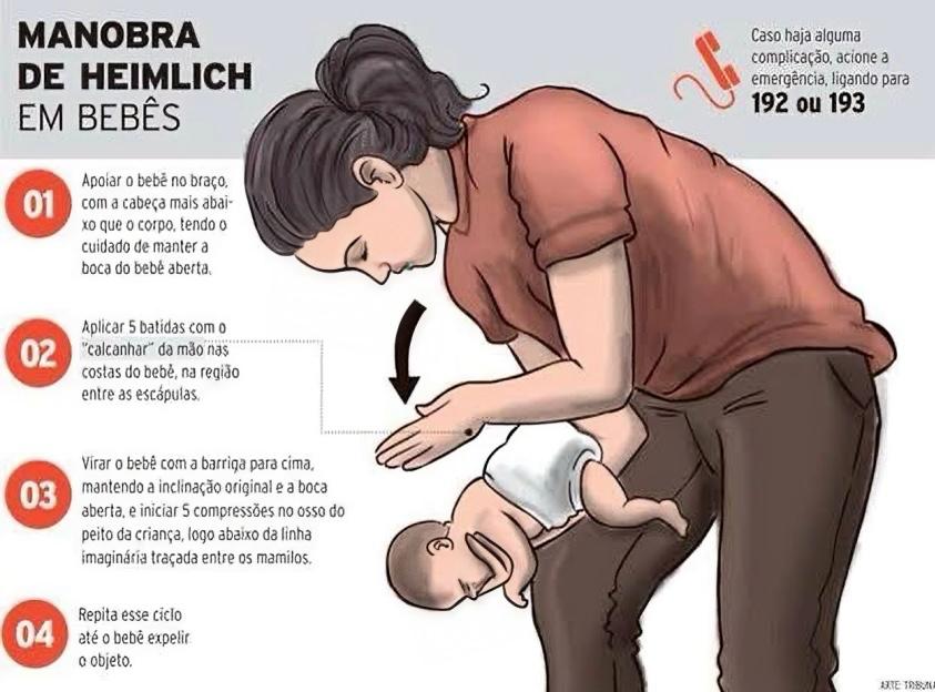 Manobra de Heimlich