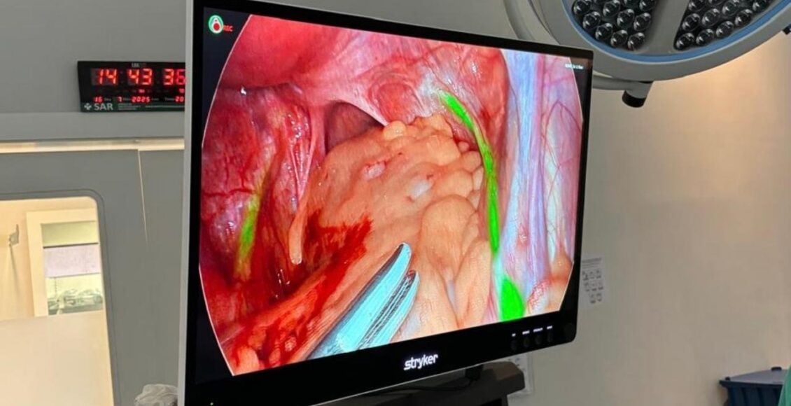 Tacchini Bento Gonçalves investe em nova torre de vídeo para ampliar precisão e segurança em cirurgias